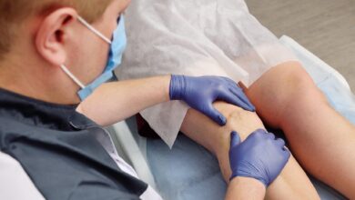 vascular surgery