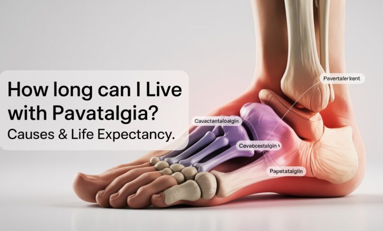 How Long Can You Live with Pavatalgia?